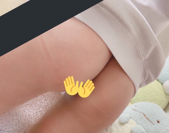 パイパン新人ナース2